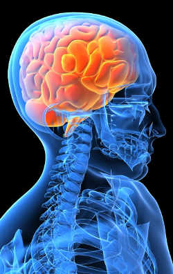 frontotemporal-dementia