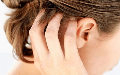 remedies for itchy scalp